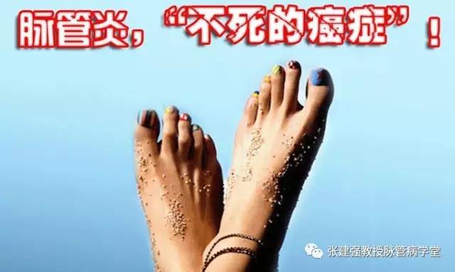 得了脉管炎可以吃韭菜吗,脉管炎怎么解决