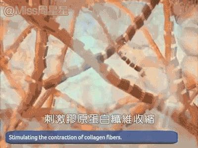 专家来告诉你美容仪真的管用吗,美容仪真的有用吗运用了哪些原理