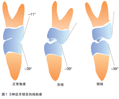 牙齿矫正骨钉发炎什么症状,牙齿矫正会出现哪种症状