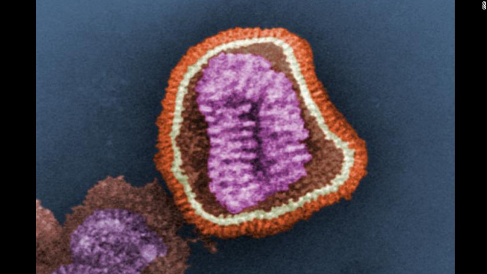 流感毒株超九成为h3n2怎样治疗,埃默里大学研究人员