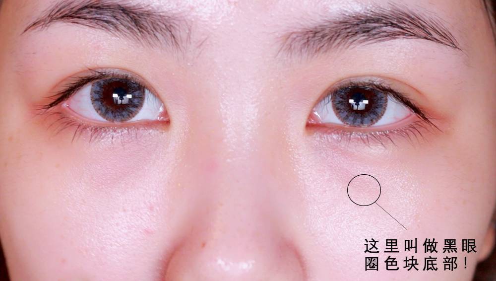 如何彻底解决黑眼圈小窍门,黑眼圈如何缓解一下就好了