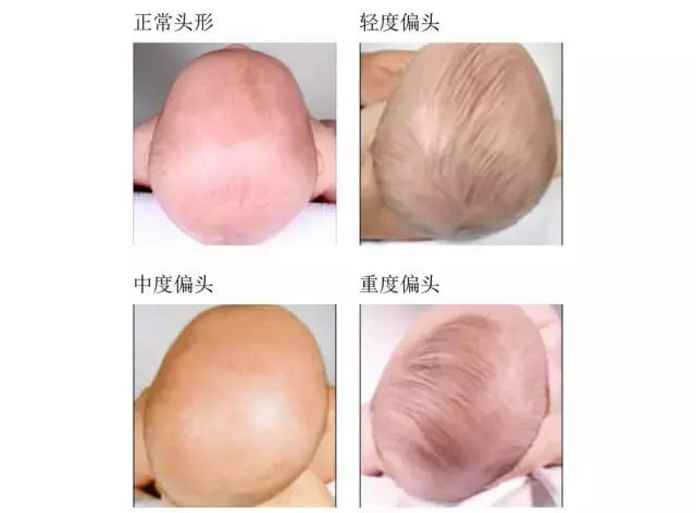 宝宝的正确睡姿新手妈妈一学就会,宝宝正确睡姿该如何