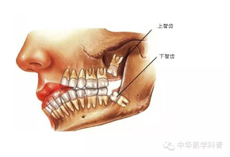 关于长智齿痛的心情说说,智齿说说朋友圈配图
