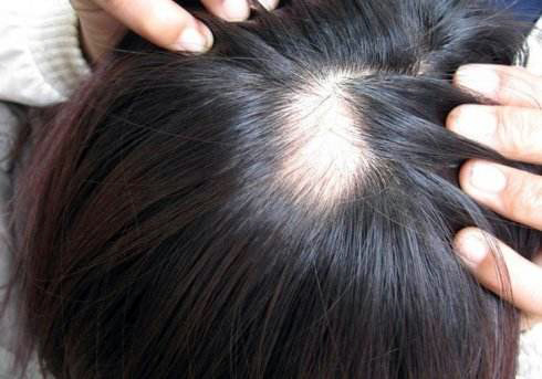 身体器官的衰老不可避免,人体机能和生命健康科普