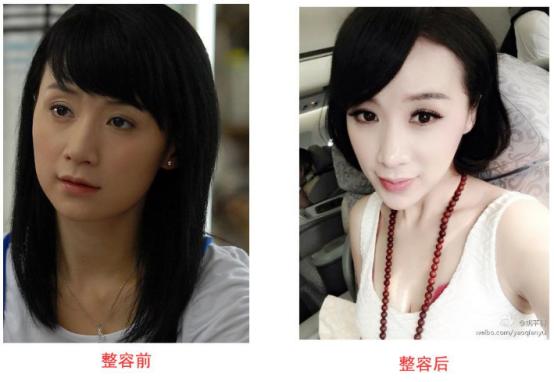 杨幂佟丽娅都给她做过配，但好像自从她整容消息传出后就少出现了