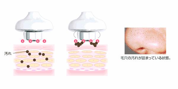 绉戝绉嶈崏,绉戝鎶よ偆鐩茬洰绉嶈崏