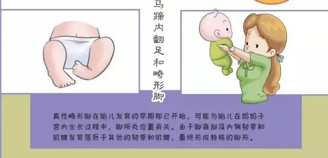 宝宝穿扶站鞋有必要吗,9个月宝宝扶站鞋