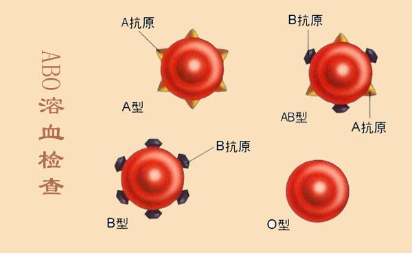 备孕必做检查准爸准妈千万别忽略,孕前优生优育检查项目有哪些