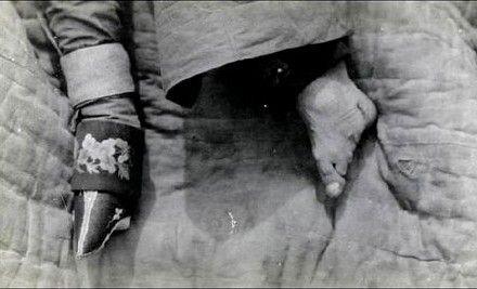 古代女子缠足对生活的影响,古代女人缠脚有哪些好处