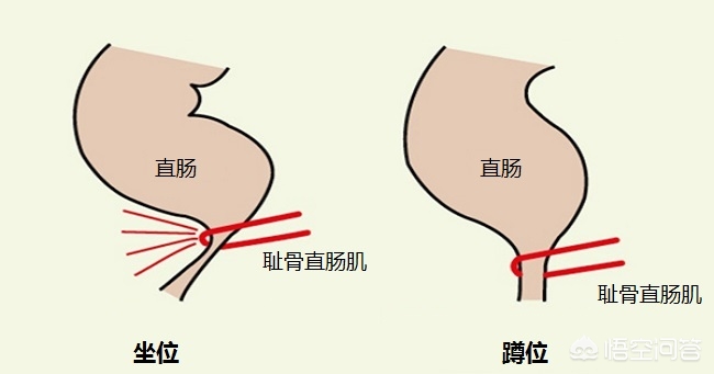 便秘的原因有哪些,什么原因导致便秘