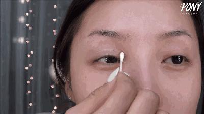 双眼皮100种整形图解,双眼皮整形全程讲解