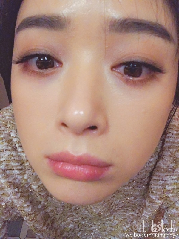 双眼皮100种整形图解,双眼皮整形全程讲解