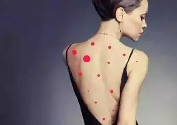 前胸后背长痘痘皮肤病,前胸后背长痘痘擦什么药