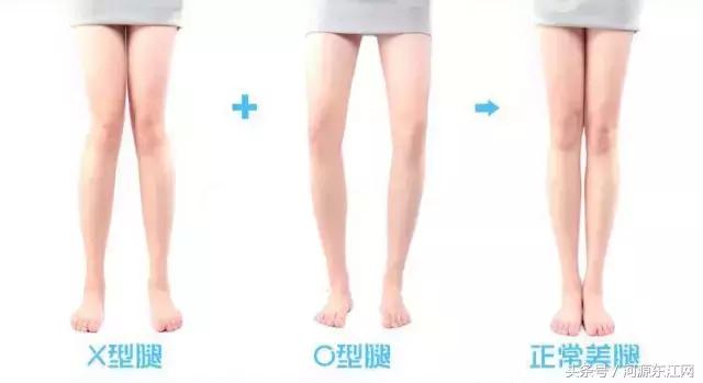 你的双腿合得拢吗？双腿合不拢意味着什么