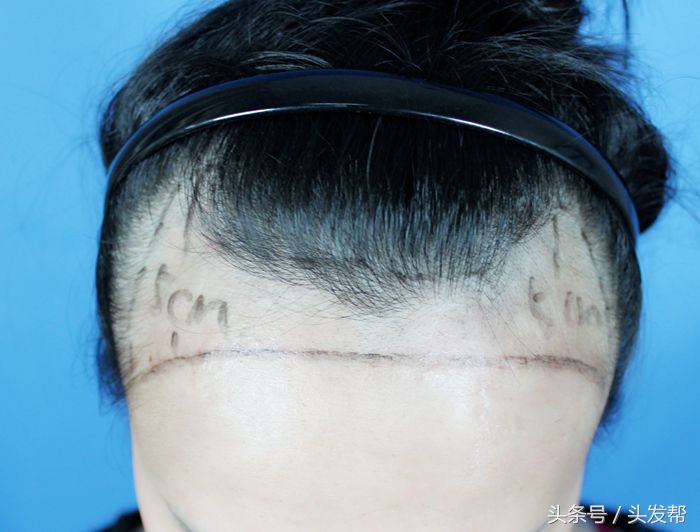 唐嫣遮挡发际线刘海,发际线太高是唐嫣五官硬伤