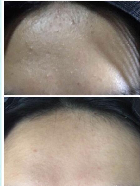 日系爽肤水推荐,十大公认最好的爽肤水价格