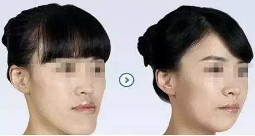 孩子牙齿畸形怎么办,小孩子牙畸形怎么办