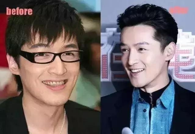 孩子牙齿畸形怎么办,小孩子牙畸形怎么办