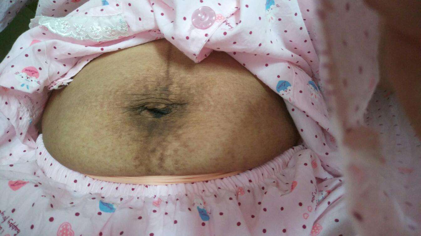 生完宝宝肚子还那么大？真正的原因在这里！