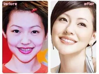 孩子牙齿畸形怎么办,小孩子牙畸形怎么办