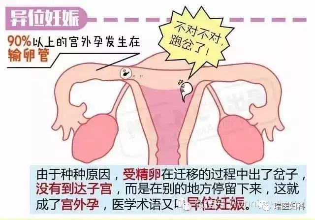 迷路种子,迷路的种子