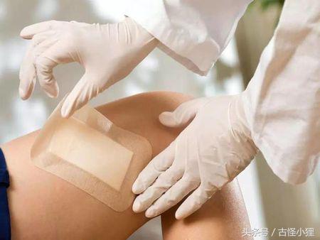 细疤痕怎么去掉最好方法,去除多年疤痕教你一个小妙招