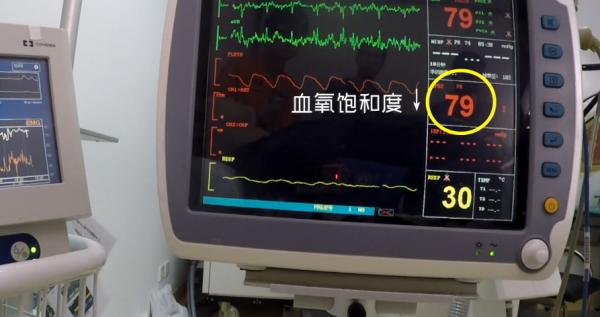 吸入笑气气体有什么危害,笑气的化学成分及其危害