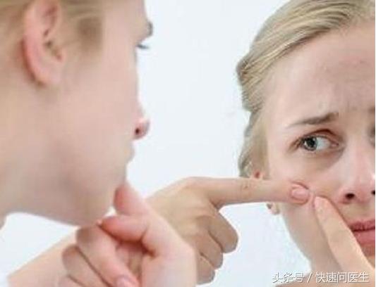 去除暗疮印最好的方法,脸暗疮怎么治疗好得快