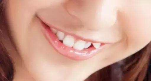 孩子牙齿畸形怎么办,小孩子牙畸形怎么办