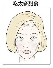 肤色不均痘印暗沉黑眼圈,长痘有法令纹真的会让人自卑