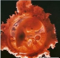 孕期记录第八周,我怀孕八周才看到孕囊正常吗