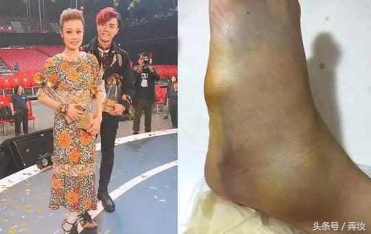 杨幂的脚很臭，而这些女明星的脚“惨不忍睹”