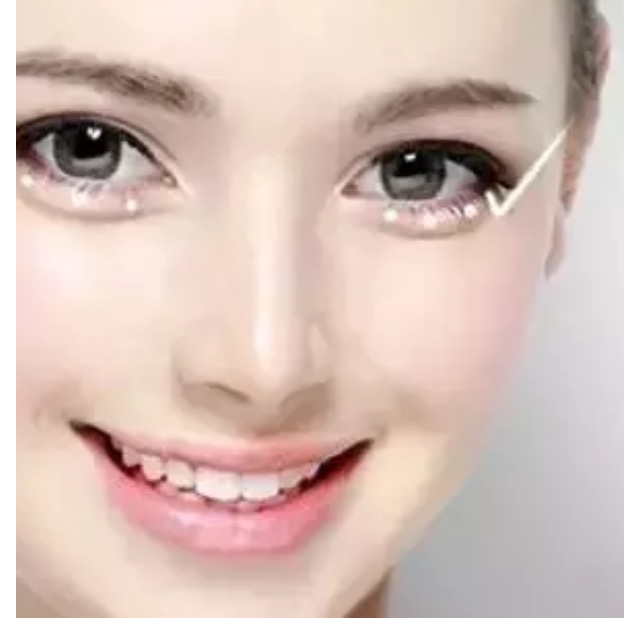 眼袋和卧蚕的区别看完你就知,卧蚕眼袋还在傻傻分不清楚