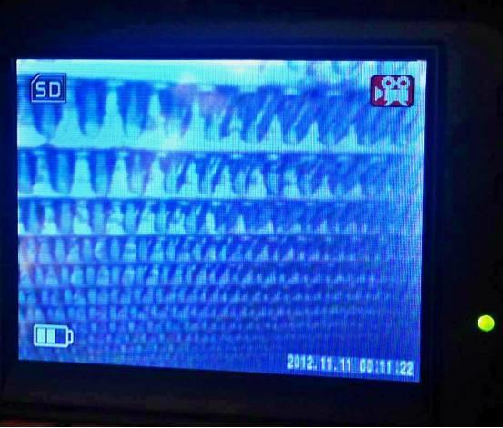 空调管路杀菌和蒸发箱清洗的区别,朗逸清洗蒸发箱的正确方法和步骤