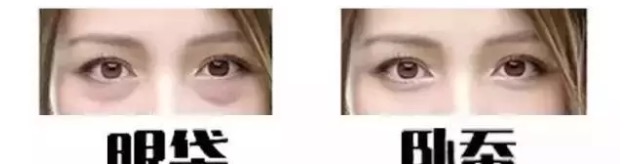 眼袋和卧蚕的区别看完你就知,卧蚕眼袋还在傻傻分不清楚
