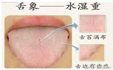 夏季吹空调冷热交替感冒怎么治,预防夏季感冒小常识