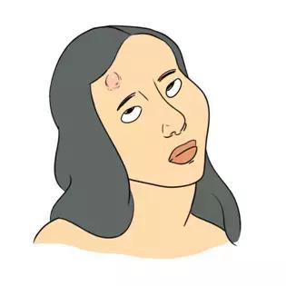 长痘痘的原因你知道有多少,长痘痘的原因你了解多少