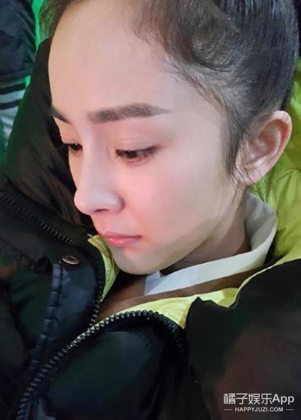 笑容引起的法令纹怎么解决,怎么样的笑容可以改善法令纹