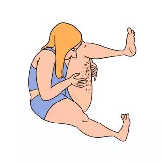 长痘痘的原因你知道有多少,长痘痘的原因你了解多少