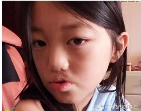 孕期做到这几点宝宝远离兔唇,怀孕过程中怎么避免孩子兔唇