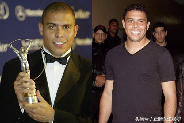 盘点整过牙的球星,还记得这些日益老去的球星吗