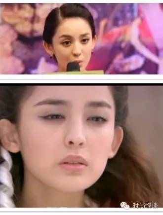 杨紫问怎么去除天生的法令纹！刘诗诗、娜扎也想知道答案啊！