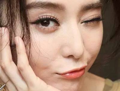 激光去眼袋恢复过程照片,激光去眼袋最真实的经历