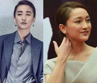 激光去眼袋恢复过程照片,激光去眼袋最真实的经历