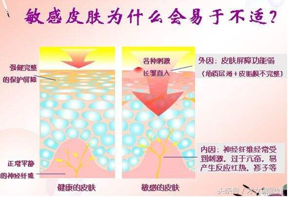 皮肤屏障受损引起过敏中医怎么治,皮肤过敏障碍症状