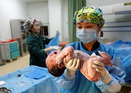 胎儿分娩用吸引器,新生儿难产负压吸引术