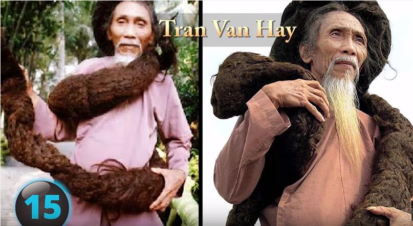 他们才是真正的超人，再大的挫折都挫不到他们，头不全又怎样