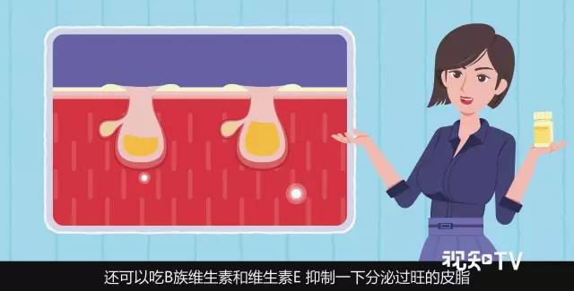 异维a酸红霉素凝胶去黑头缩毛孔,长沙医美去黑头缩毛孔大概多少钱