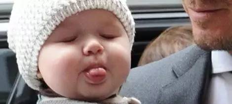 2岁儿童牙齿反颌矫正方法图片,12岁前必须矫正牙颌畸形吗