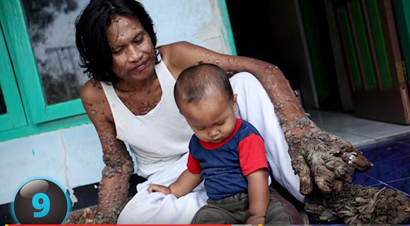 他们才是真正的超人，再大的挫折都挫不到他们，头不全又怎样